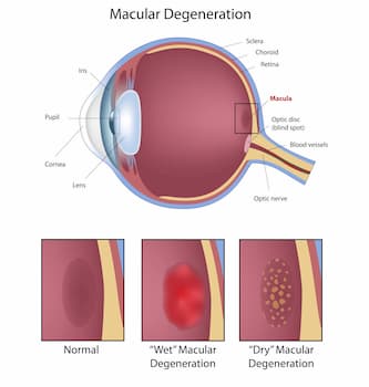 AMD Diagram