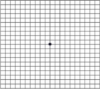 Amsler Grid