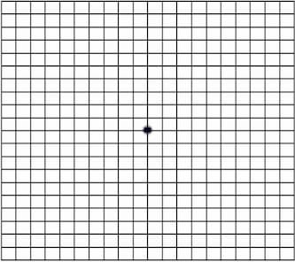 Amsler Grid